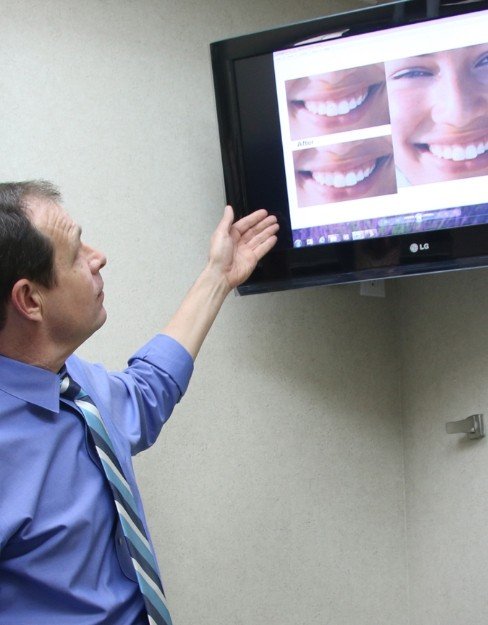 Dentist showing patient the result of smile makeovers