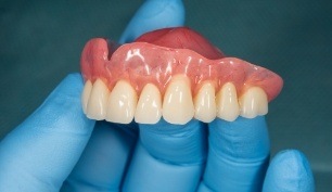 Hand holding a denture prior to dental implant placement