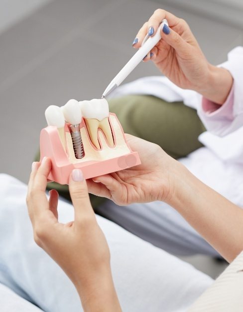Dentist and dental patient looking at dental implant model