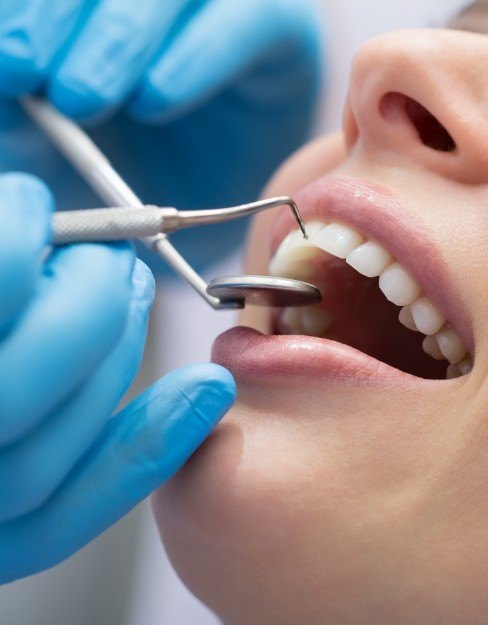 Close up of a person receiving an exam from their dentist