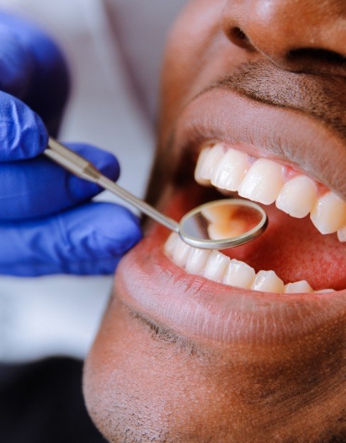 Dentist examining smile after tooth colored filling restorative dentistry