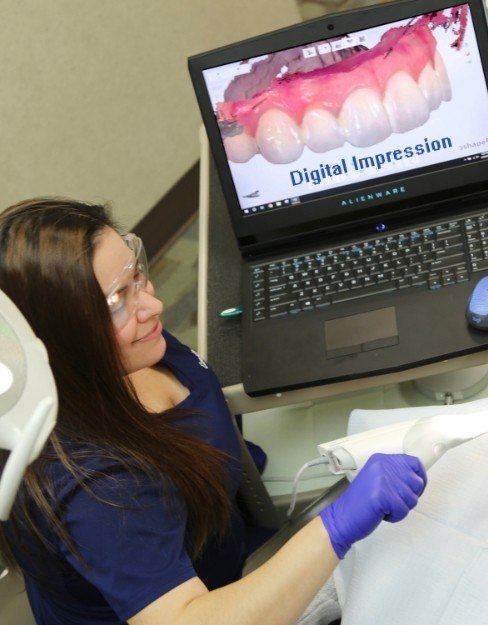 Patient getting digital dental impression taken in Houston