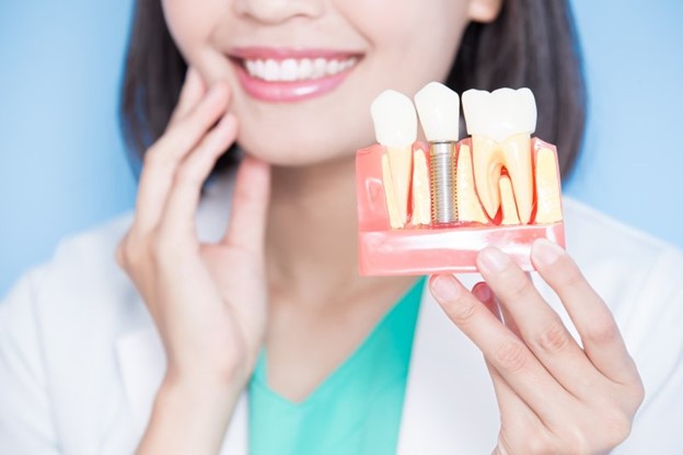 Woman holding a model of dental implants.