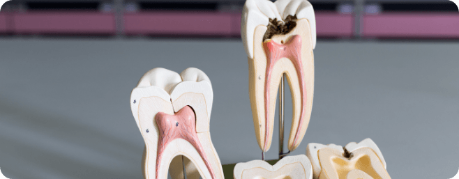 Two tooth models in Houston