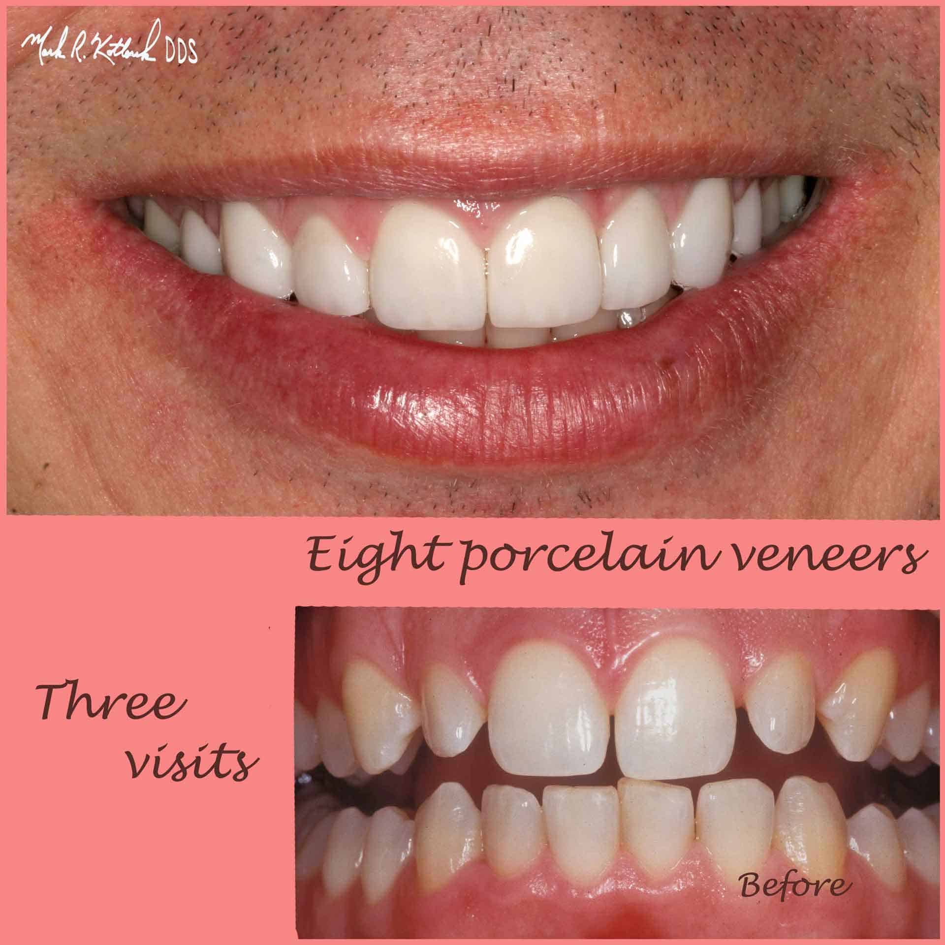 Cosmetic dentist 77024