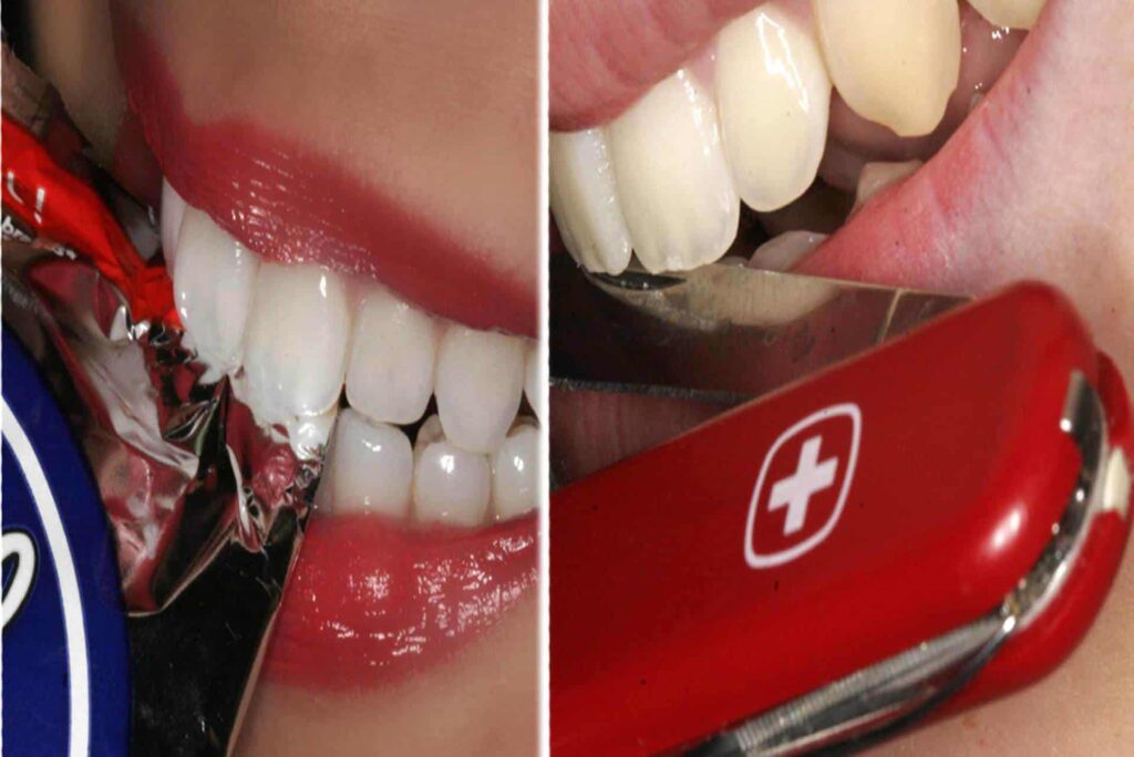 dental injury tooth trauma