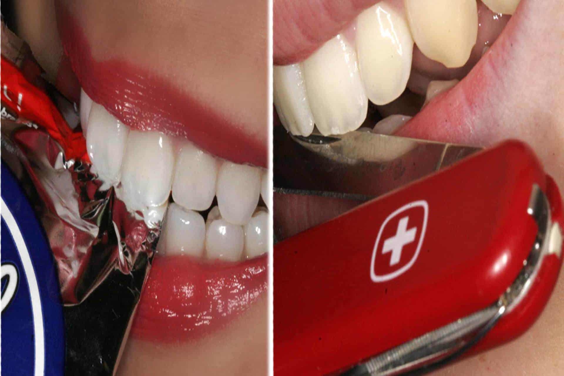 dental injury tooth trauma