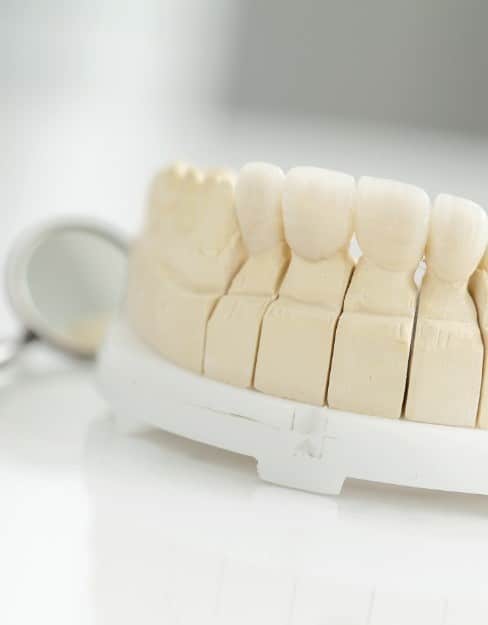 Replace Missing Teeth Houston TX