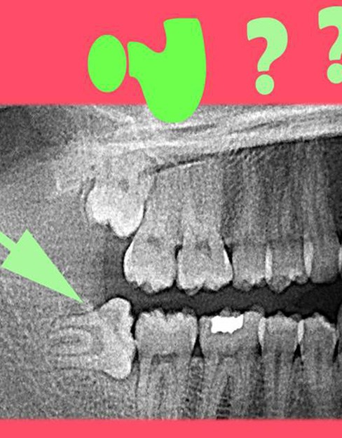 oral surgery 2 2