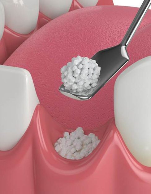 oral surgery 5 2