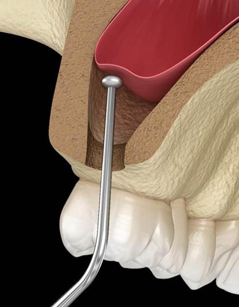 oral surgery 6 2