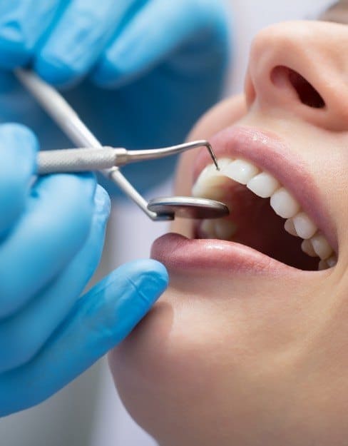 periodontal 4