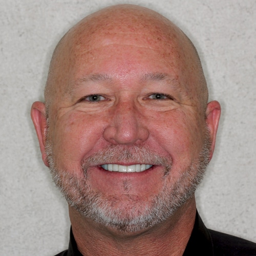 After Image: Dental Implant - front