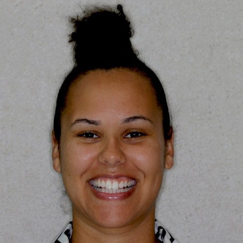 After Image: Teeth Whitening - front