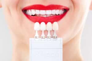 Close up of a woman having veneers color-matched to her teeth for a metal-free dental restoration