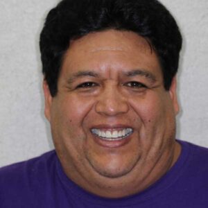 After Image: Front Tooth Composite Bonding