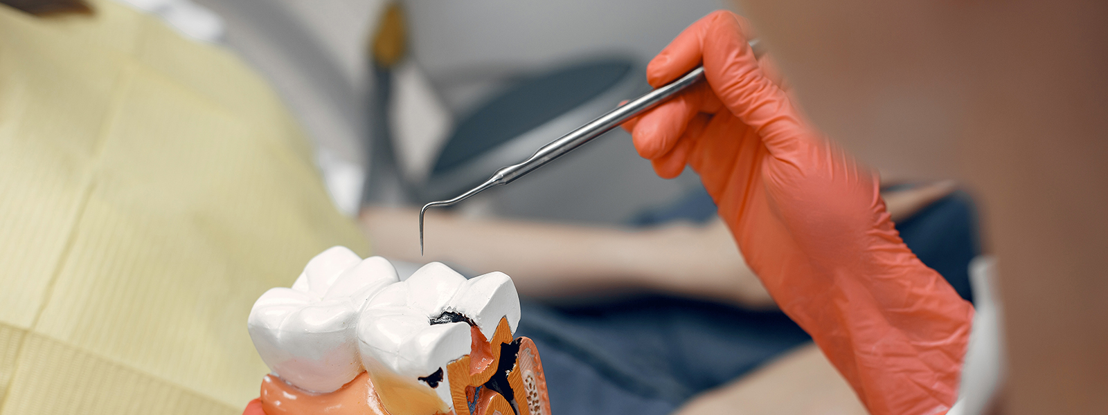 model tooth dentist doctor shows patient tooth reception dentist s office