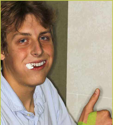 dental extraction patient