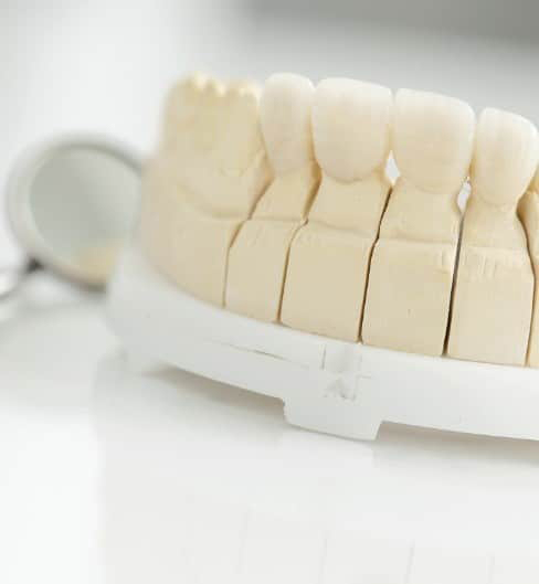 missing teeth 2