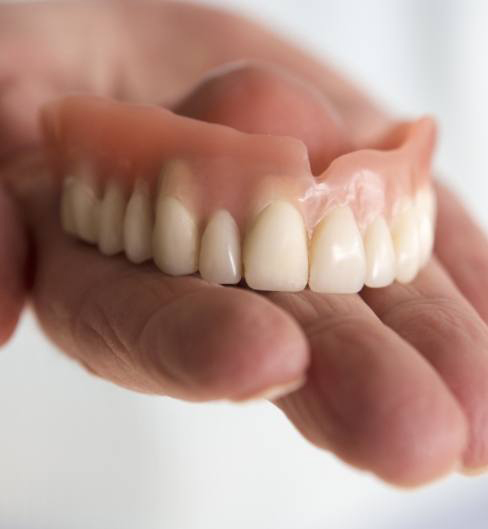 missing teeth 3