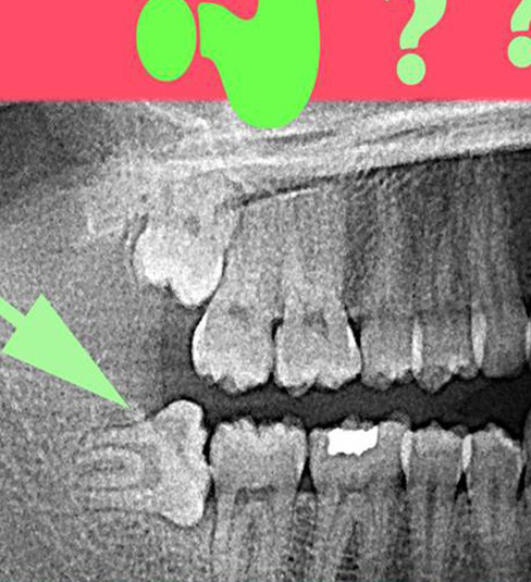 oral surgery 2 2