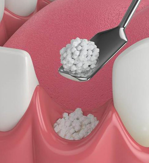 oral surgery 5 2