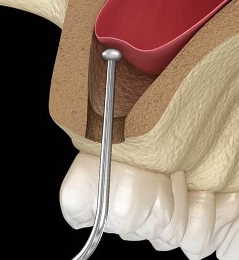 oral surgery 6 2
