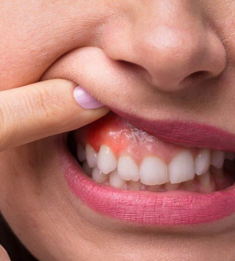 periodontal 2