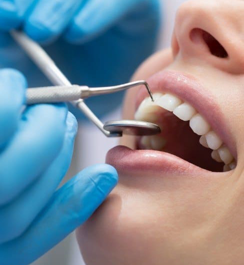 periodontal 4