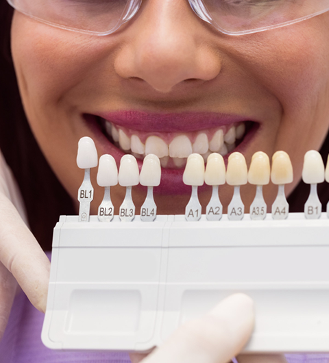 Refresh Your Smile with Veneers