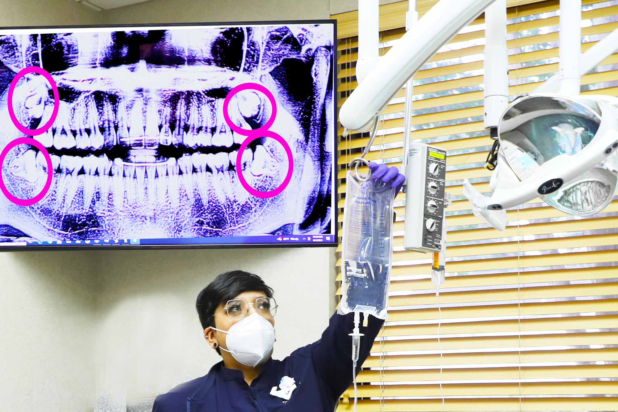dental impaction xray