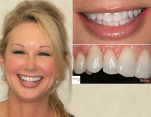 Cosmetic dentistry example
