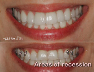 cosmetic dental care2