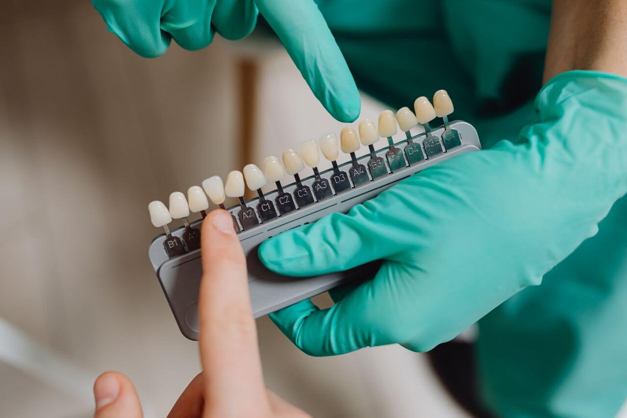 Dental professional with gloves pointing to a dental shade guide for veneers in a clinic.